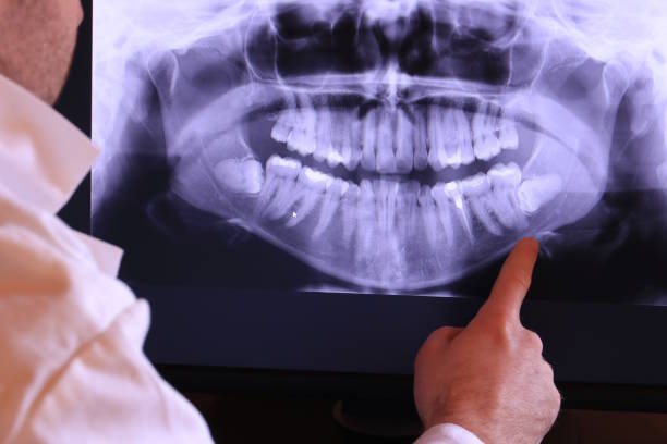 Best Urgent Tooth Repair  in Kingston, OK