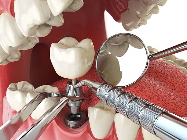Best Tooth Pain Emergency Relief  in Kingston, OK