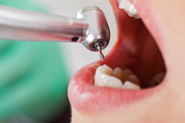 Best Dentist for Dental Trauma  in Kingston, OK